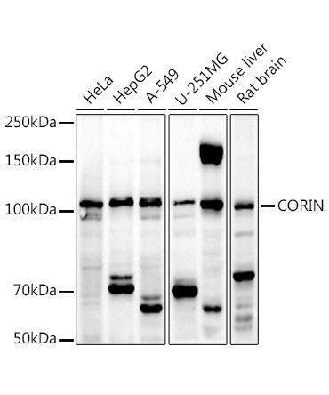CORIN Rabbit Polyclonal Antibody