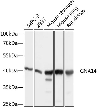 GNA14 Rabbit Polyclonal Antibody