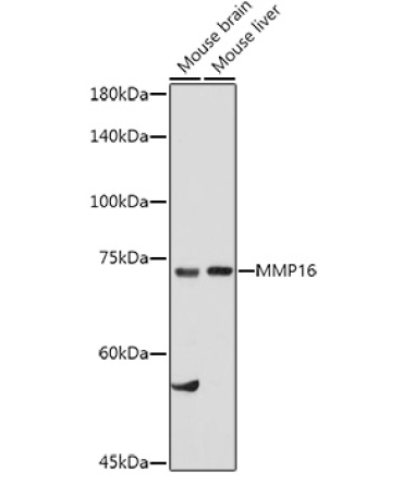MMP16 Rabbit Polyclonal Antibody