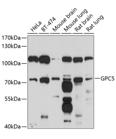 GPC5 Rabbit Polyclonal Antibody