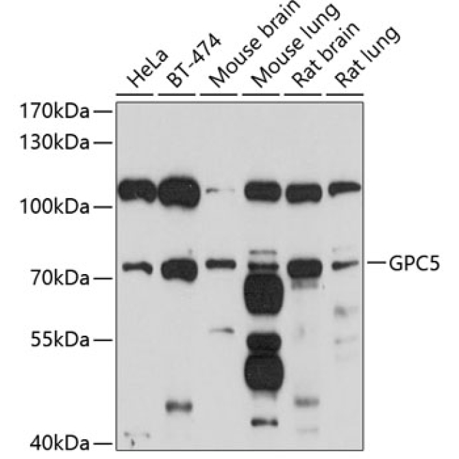 GPC5 Rabbit Polyclonal Antibody