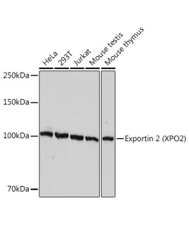 Exportin 2 (XPO2) Rabbit Monoclonal Antibody