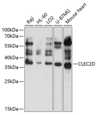 CLEC2D Rabbit Polyclonal Antibody