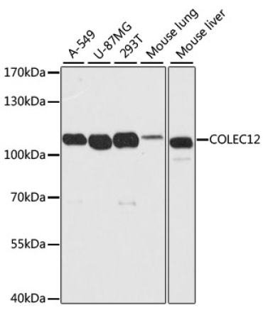 COLEC12 Rabbit Polyclonal Antibody
