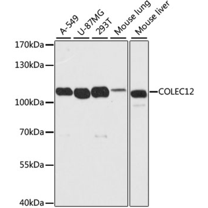 COLEC12 Rabbit Polyclonal Antibody