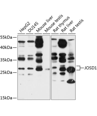 JOSD1 Rabbit Polyclonal Antibody