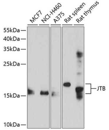JTB Rabbit Polyclonal Antibody