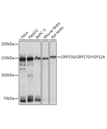 ORP150/GRP170/HSP12A Rabbit Monoclonal Antibody