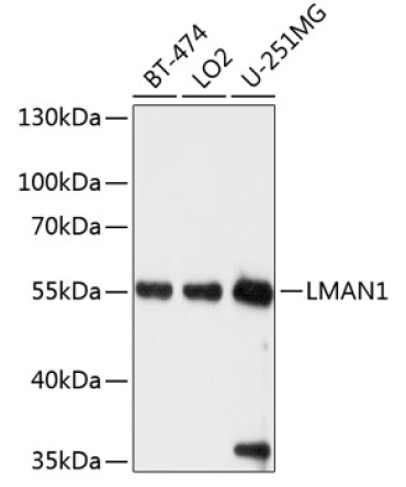 LMAN1 Rabbit Polyclonal Antibody