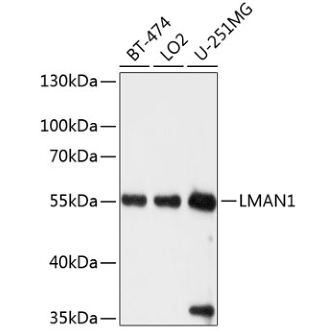 LMAN1 Rabbit Polyclonal Antibody