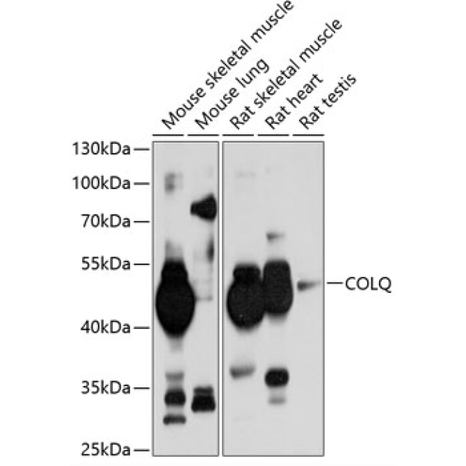 COLQ Rabbit Polyclonal Antibody