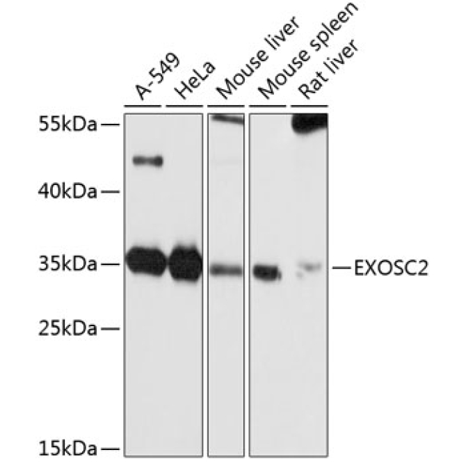 EXOSC2 Rabbit Polyclonal Antibody
