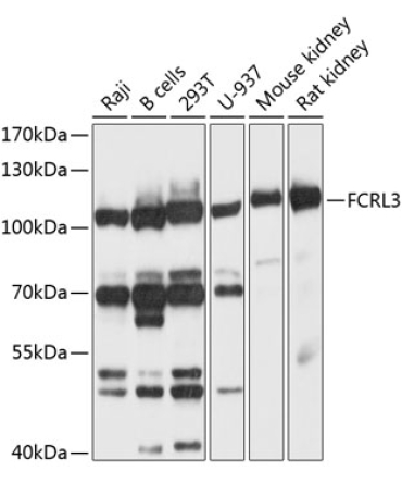 FCRL3 Rabbit Polyclonal Antibody