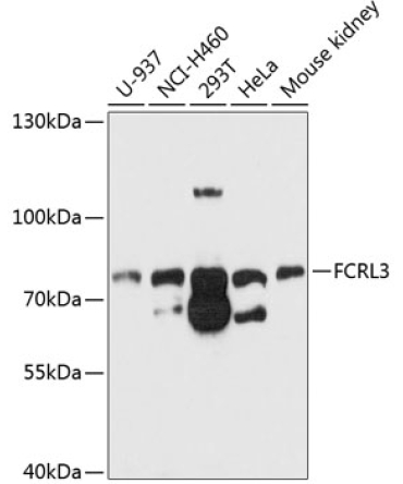 FCRL3 Rabbit Polyclonal Antibody