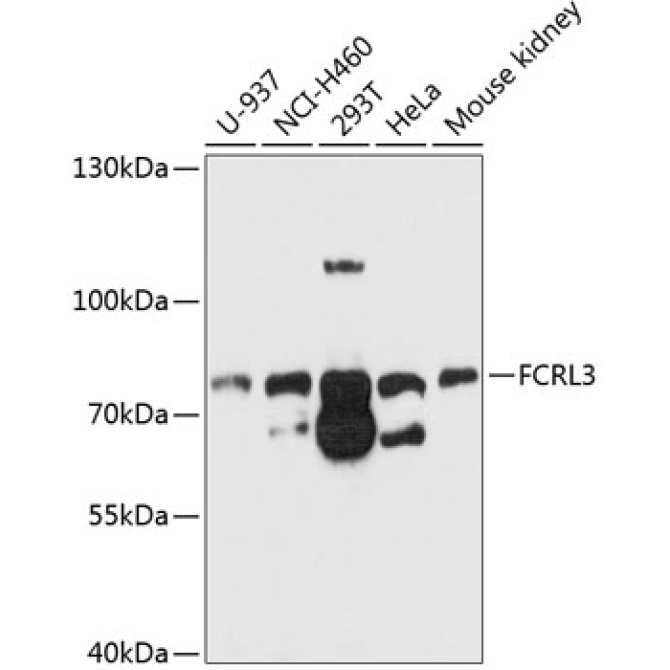 FCRL3 Rabbit Polyclonal Antibody