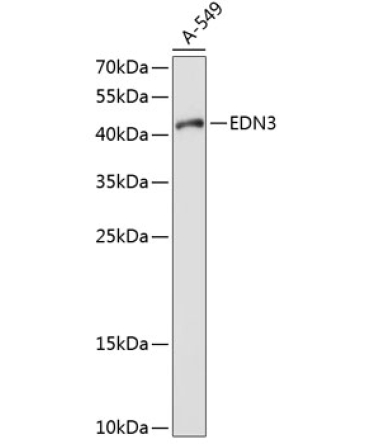 EDN3 Rabbit Polyclonal Antibody