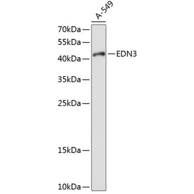 EDN3 Rabbit Polyclonal Antibody