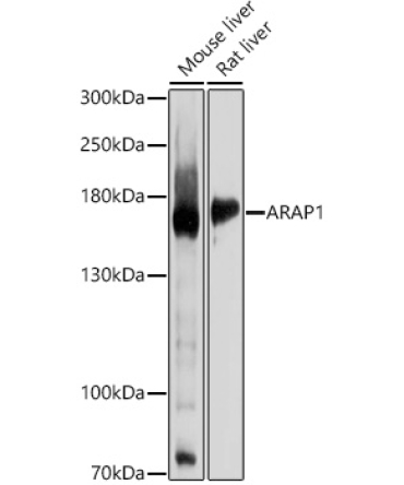 ARAP1 Rabbit Polyclonal Antibody
