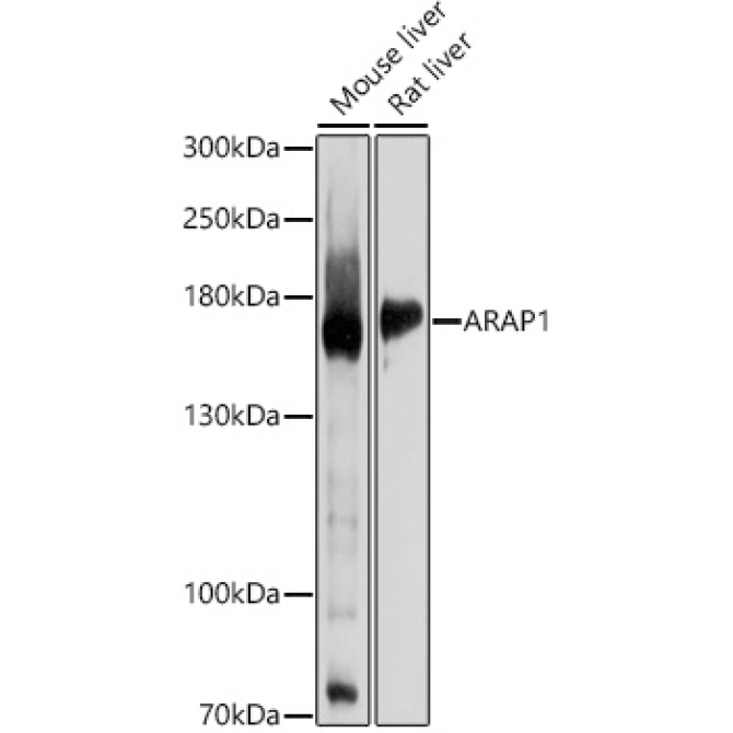 ARAP1 Rabbit Polyclonal Antibody