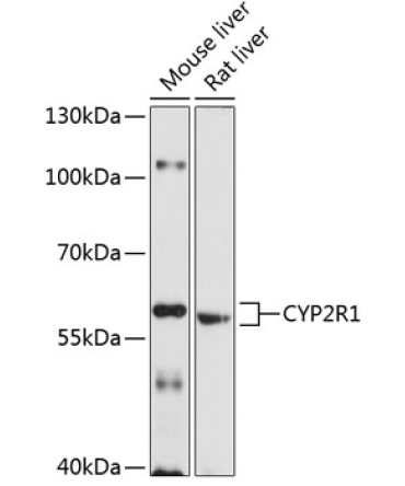 CYP2R1 Rabbit Polyclonal Antibody