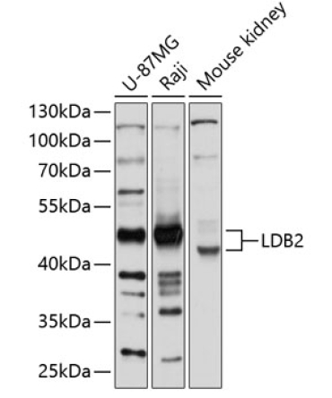 LDB2 Rabbit Polyclonal Antibody