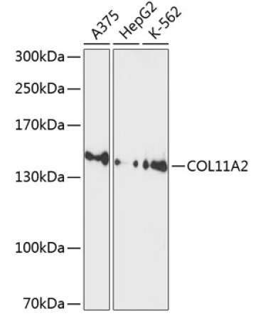 COL11A2 Rabbit Polyclonal Antibody