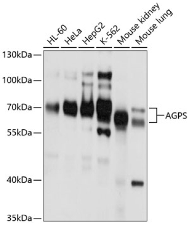 AGPS Rabbit Polyclonal Antibody