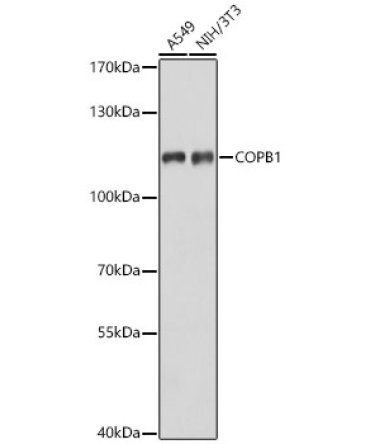 COPB1 Rabbit Polyclonal Antibody