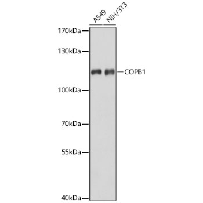 COPB1 Rabbit Polyclonal Antibody