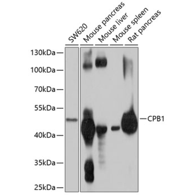 CPB1 Rabbit Polyclonal Antibody