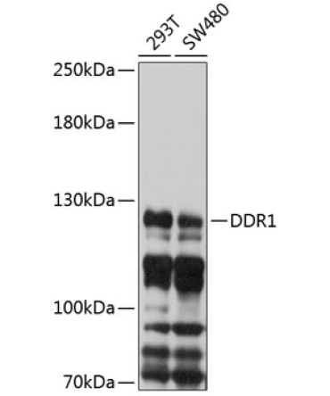 DDR1 Rabbit Polyclonal Antibody