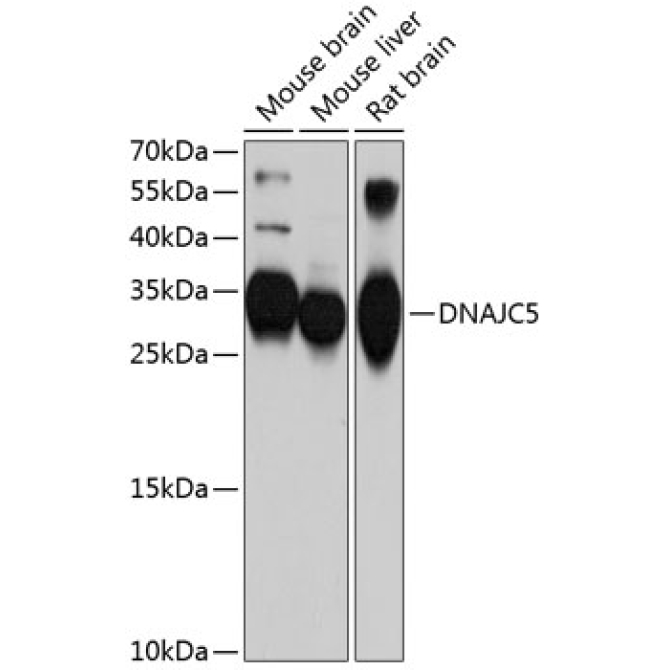 DNAJC5 Rabbit Polyclonal Antibody