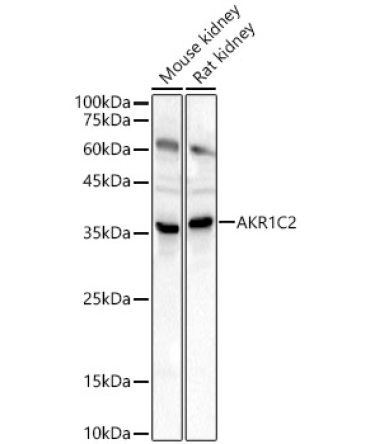 AKR1C2 Rabbit Polyclonal Antibody