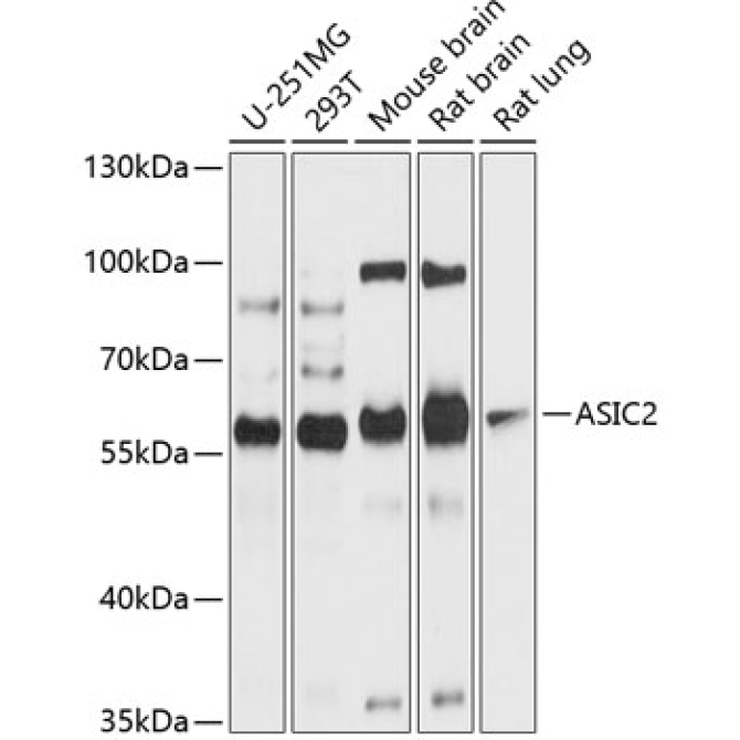 ASIC2 Rabbit Polyclonal Antibody
