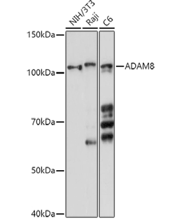 ADAM8 Rabbit Polyclonal Antibody