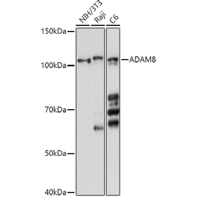 ADAM8 Rabbit Polyclonal Antibody