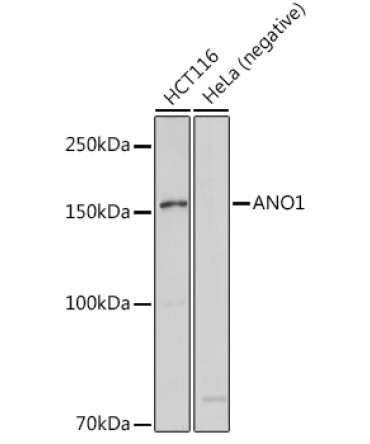 ANO1 Rabbit Polyclonal Antibody