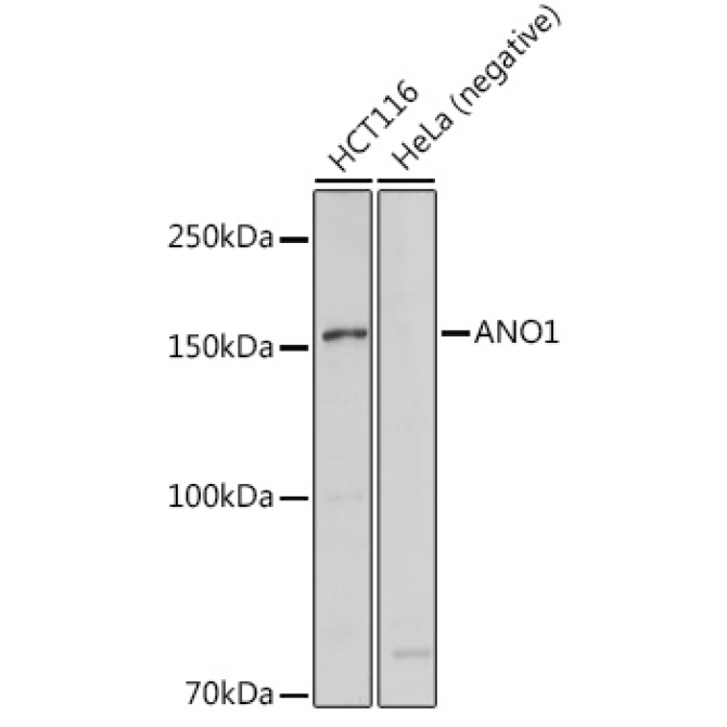 ANO1 Rabbit Polyclonal Antibody