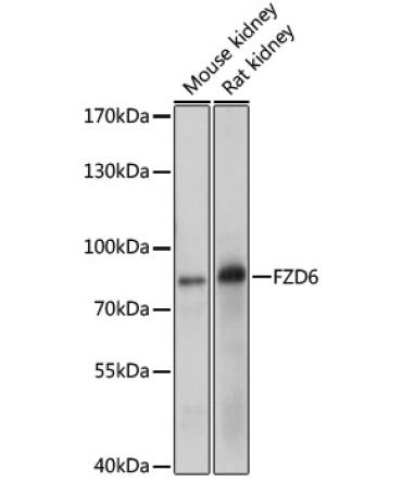 FZD6 Rabbit Polyclonal Antibody