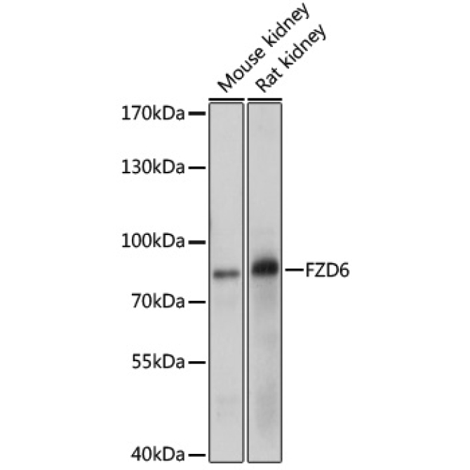 FZD6 Rabbit Polyclonal Antibody