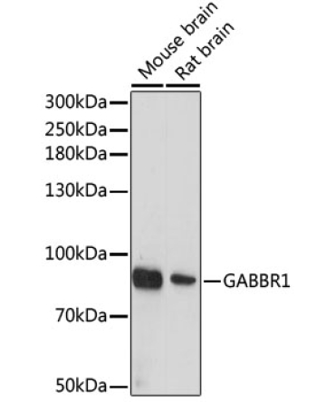 GABBR1 Rabbit Polyclonal Antibody