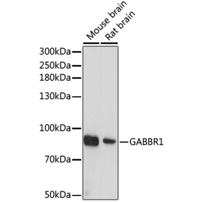 GABBR1 Rabbit Polyclonal Antibody