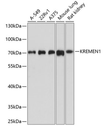 KREMEN1 Rabbit Polyclonal Antibody