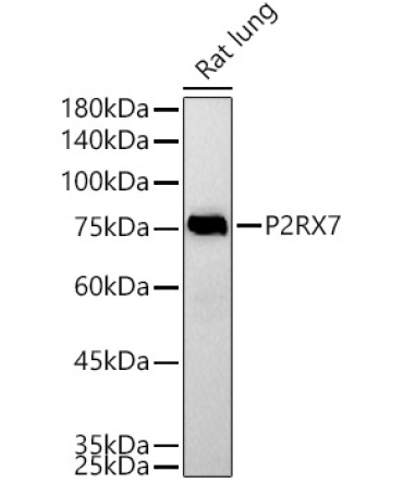 P2RX7 Rabbit Polyclonal Antibody