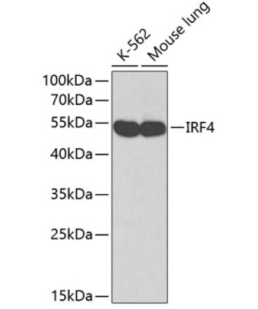 IRF4 Rabbit Polyclonal Antibody