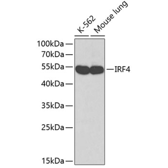 IRF4 Rabbit Polyclonal Antibody