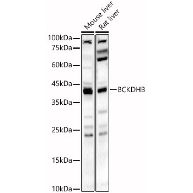 BCKDHB Rabbit Polyclonal Antibody