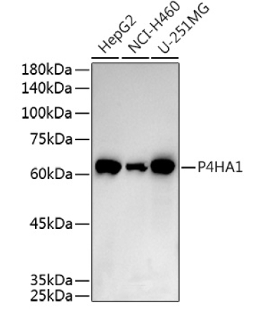 P4HA1 Rabbit Polyclonal Antibody