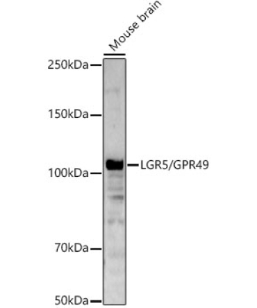LGR5/GPR49 Rabbit Polyclonal Antibody