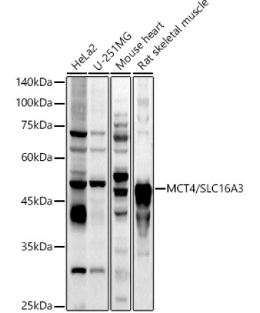 MCT4/SLC16A3 Rabbit Polyclonal Antibody